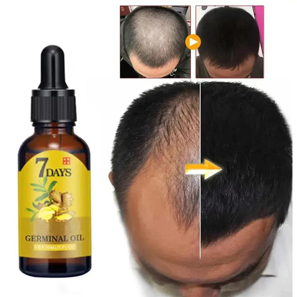 Ingrown Hair Serum - Aceite esencial de jengibre para el