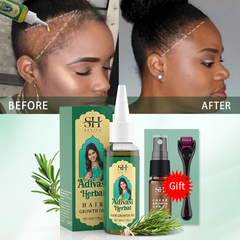 Aceite Ayurvédico para el Crec - Ingrown Hair Serum reseña y precio