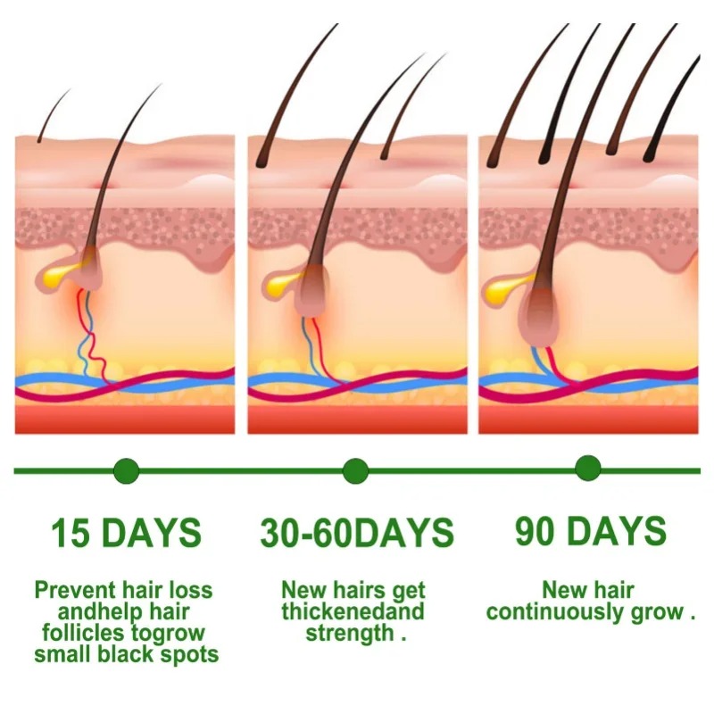 Suero para el crecimiento del  - Ingrown Hair Serum reseña y precio
