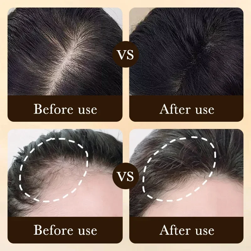 Aceite de Biotina para el Crec - Ingrown Hair Serum reseña y precio