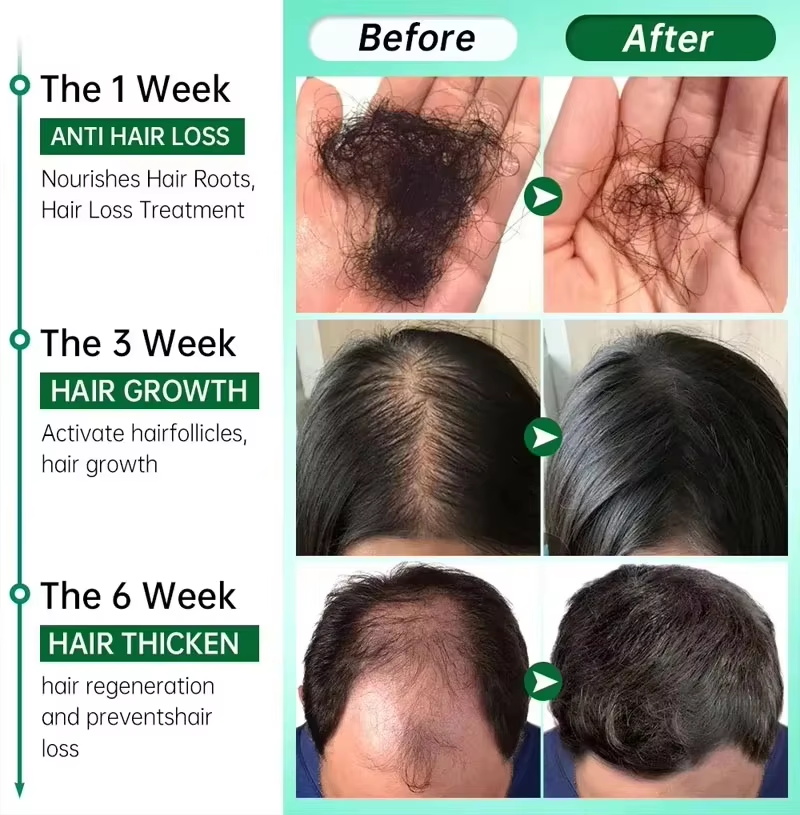 Suero para el crecimiento del  - Ingrown Hair Serum reseña y precio