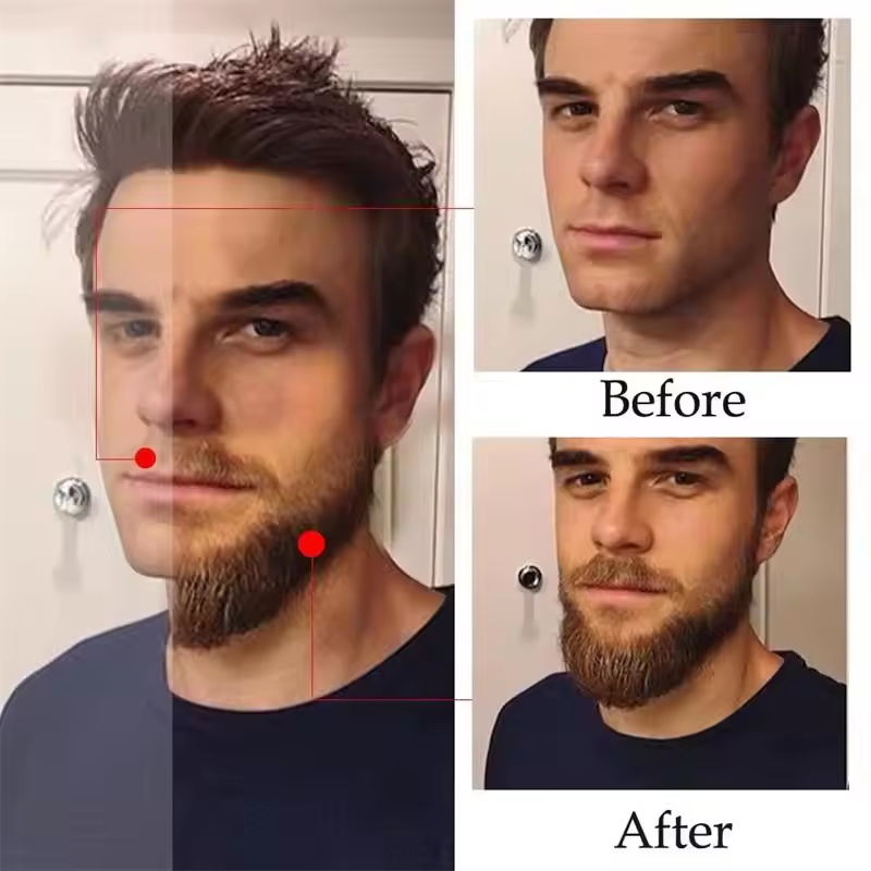 Esencia de Crecimiento Rápido  - Ingrown Hair Serum reseña y precio